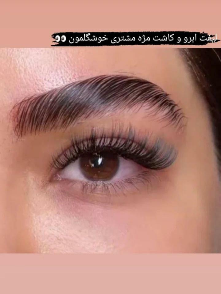 کاشت مژه